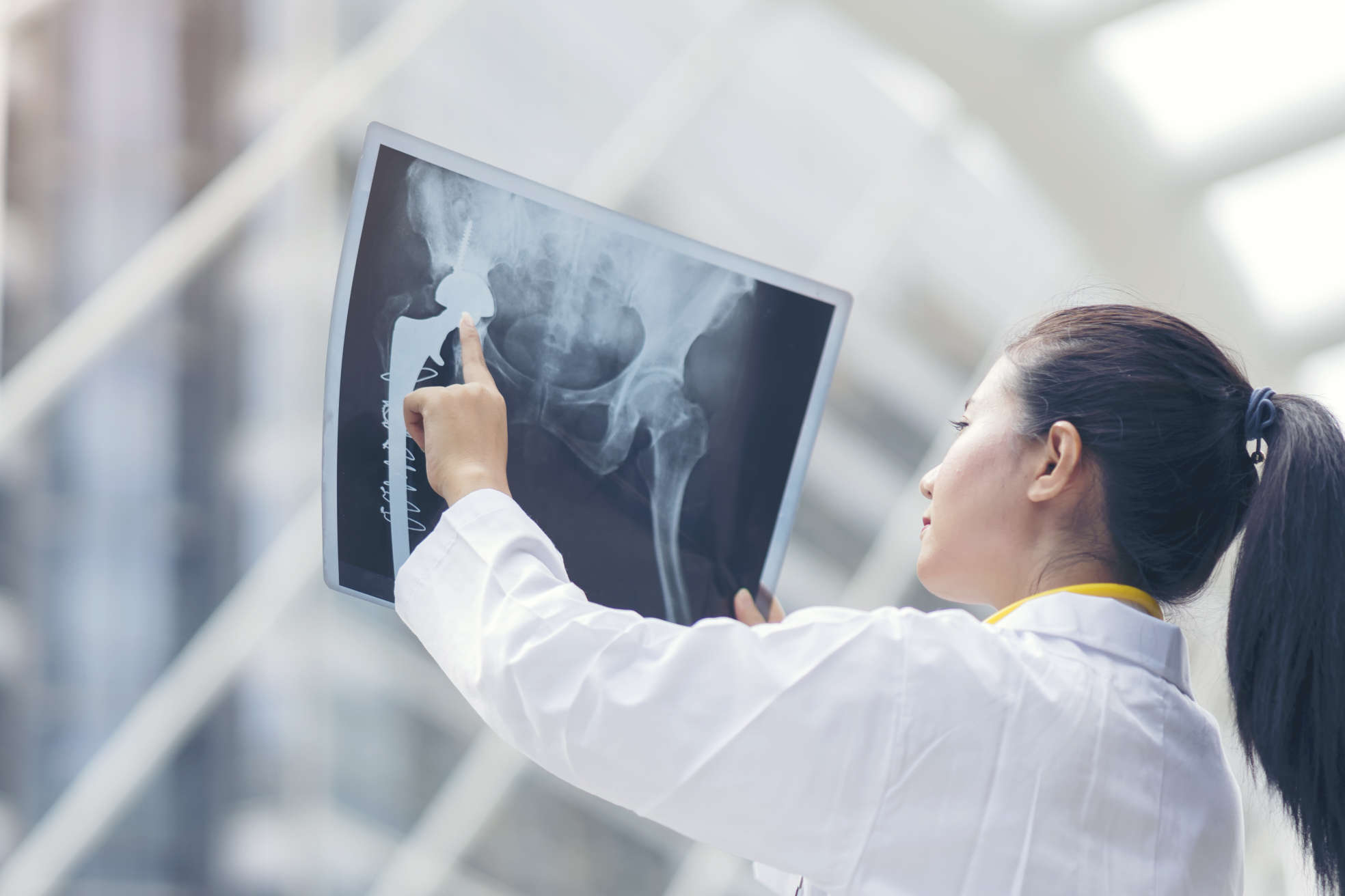 Osteogenon: Keď kosti potrebujú tichú starostlivosť a pevnú ruku